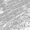 1G5C (Case 1) Muscle_003 - Copy
