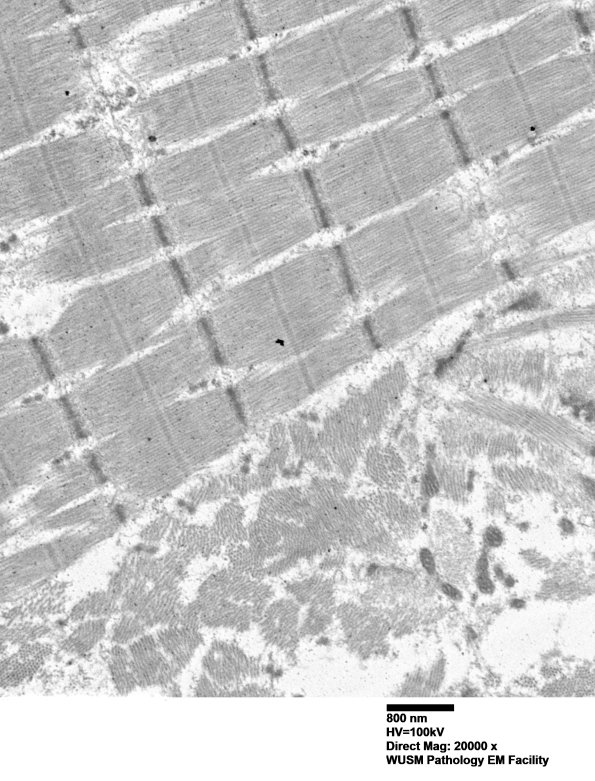 1G5C (Case 1) Muscle_003 - Copy