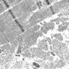 1G5D (Case 1) Muscle_007 - Copy