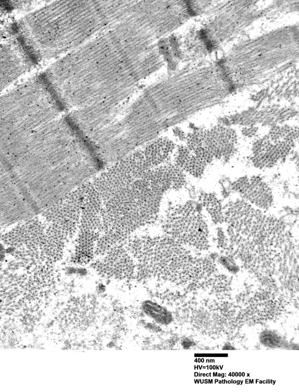 1G5D (Case 1) Muscle_007 - Copy