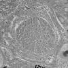 1G6 (Case 1) Muscle_023 - Copy