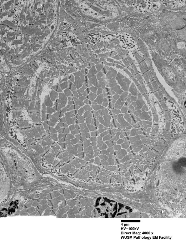 1G6 (Case 1) Muscle_023 - Copy