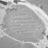 1G7A (Case 1) Muscle_043 - Copy