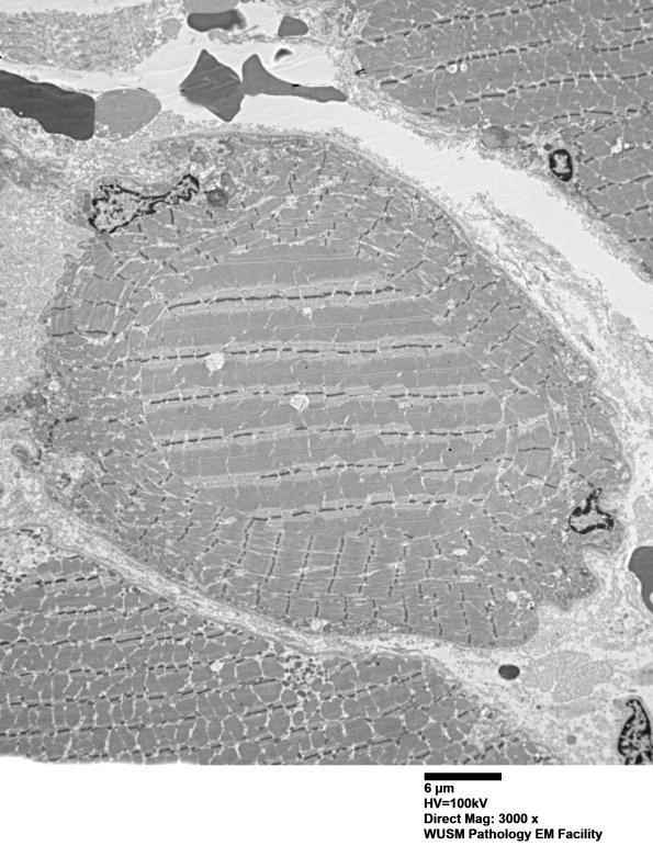 1G7A (Case 1) Muscle_043 - Copy