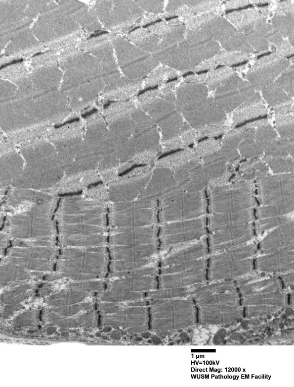 1G7B (Case 1) Muscle_045 - Copy