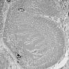 1G8A (Case 1) Muscle_036 - Copy