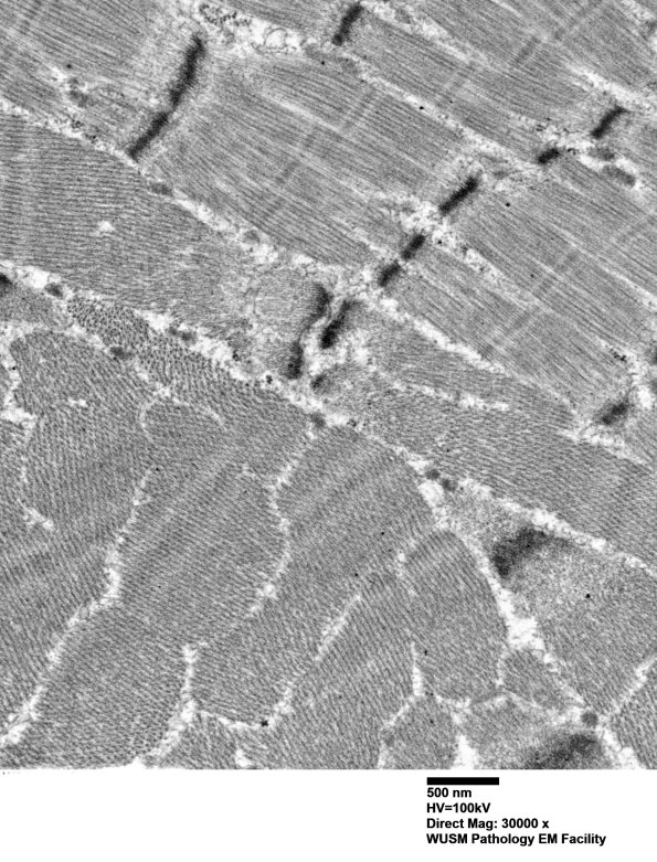 1G8B (Case 1) Muscle_038 - Copy