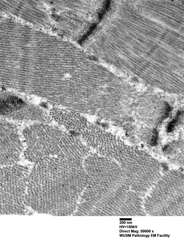1G8C (Case 1) Muscle_039 - Copy
