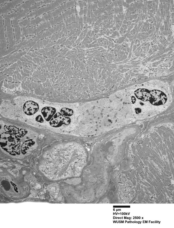 1G9A (Case 1) Muscle_008 - Copy