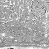 1G9B (Case 1) Muscle_012 - Copy