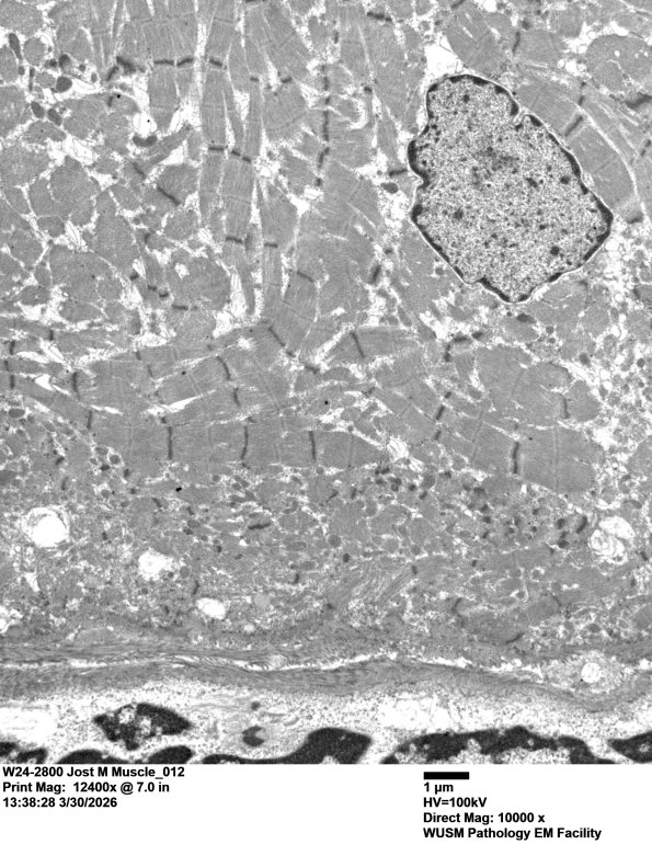 1G9B (Case 1) Muscle_012 - Copy