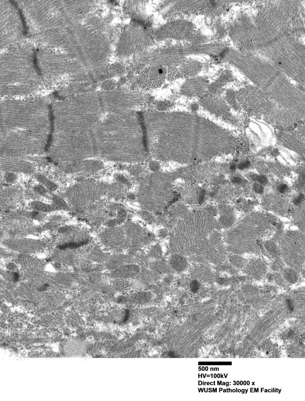 1G9C (Case 1) Muscle_013 - Copy