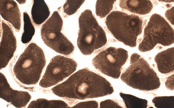 1E1B Targets (Case 1) ATPase 9.4  40X 1
