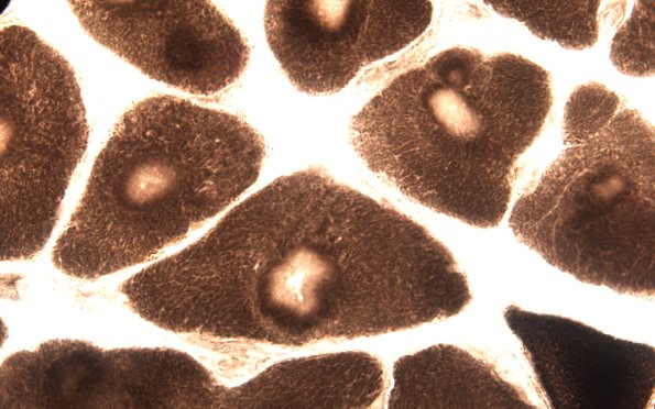 1E1CTargets (Case 1) ATPase 9.4  60X