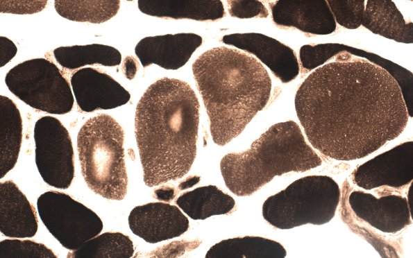 1E2B Targets (Case 1) ATPase 9.4 60X 2