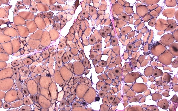 1F1A Targets (Case 1) VVG 10X