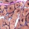 1F1B Targets (Case 1) VVG 40X