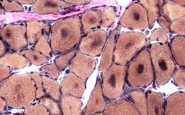 1F1B Targets (Case 1) VVG 40X