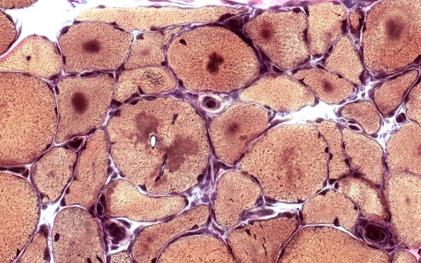 1F1C Targets (Case 1) VVG 60X