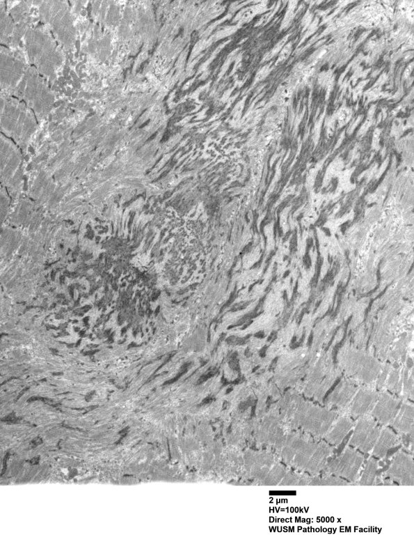 1J6A (Case 1) EM025 - Copy