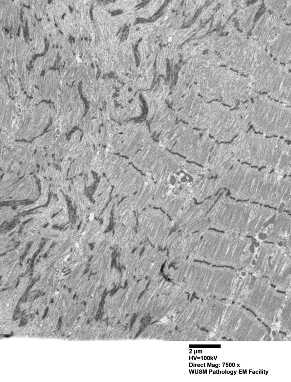 1J7B (Case 1 EM048 - Copy