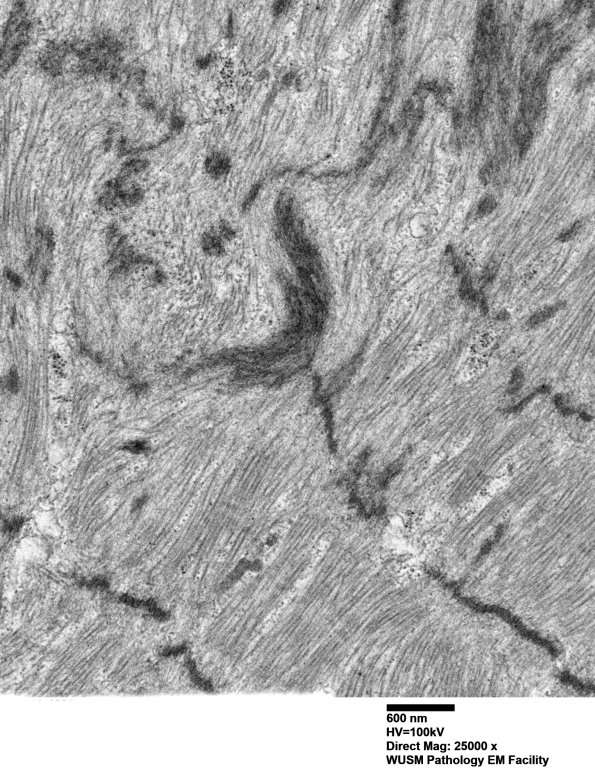 1J7C (Case 1 EM049 - Copy