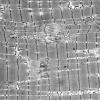 12A2 (Case 12) Muscle EM018 - Copy
