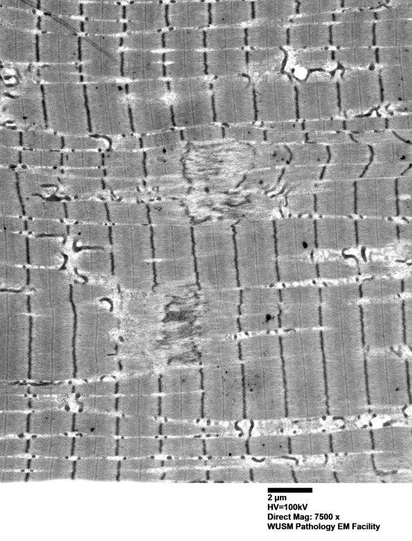 12A2 (Case 12) Muscle EM018 - Copy