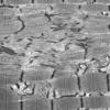 12A3 (Case 12)) Muscle EM021 - Copy