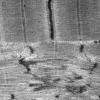 12A4 (Case 12)) Muscle EM022 - Copy