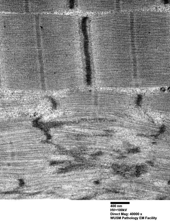 12A4 (Case 12)) Muscle EM022 - Copy