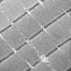1A2 (Case 1A) Deltoid_054a - Copy