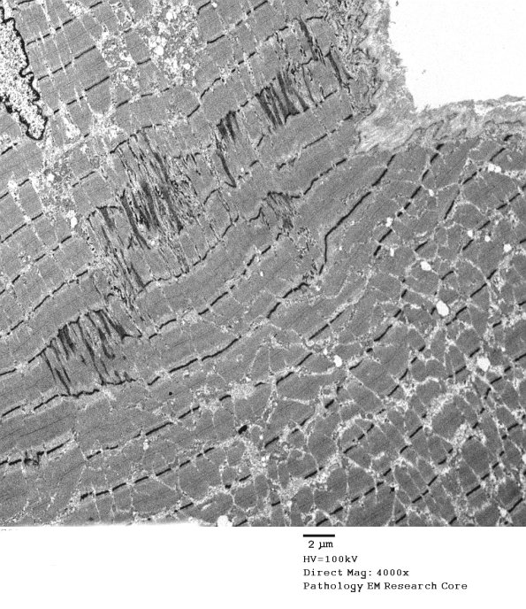 4A1-Case-4-EM082.jpg