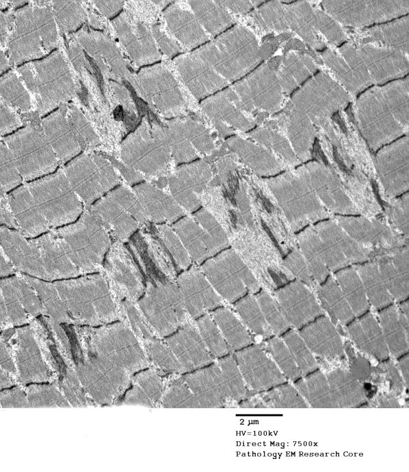 4A2-Case-4-EM088.jpg