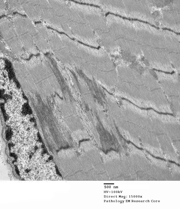 4A3-Case-4-EM036.jpg