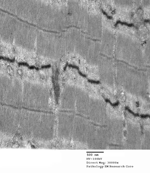 4A5-Case-4-EM044.jpg