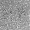 9A Paraspinal (Case 9) em030 - Copy