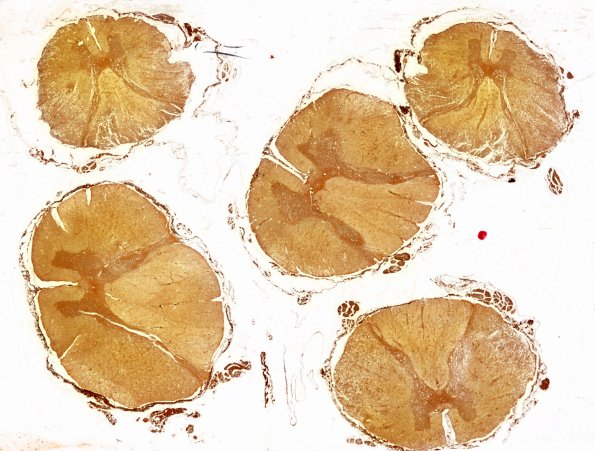 1O1 AHL (Case 1) 1 Biels whole mount (spinal cord)  2