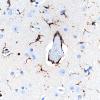 9N3 AHL (Case 9) CD163 Gray Matter 40X 2