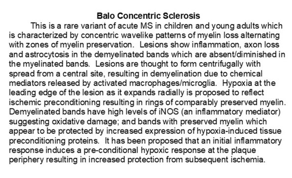 0A Balo Concentric Sclerosis - Text