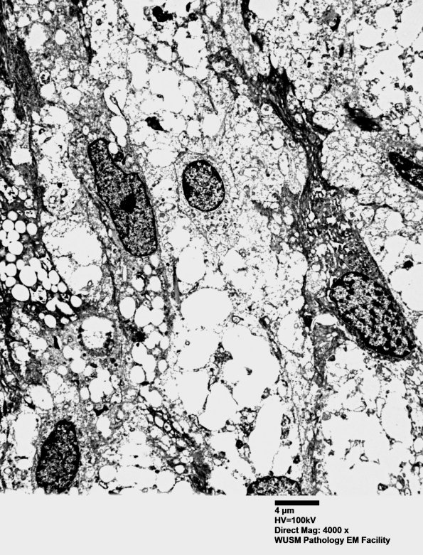 15K1 Case 15 EM 001a - Copy