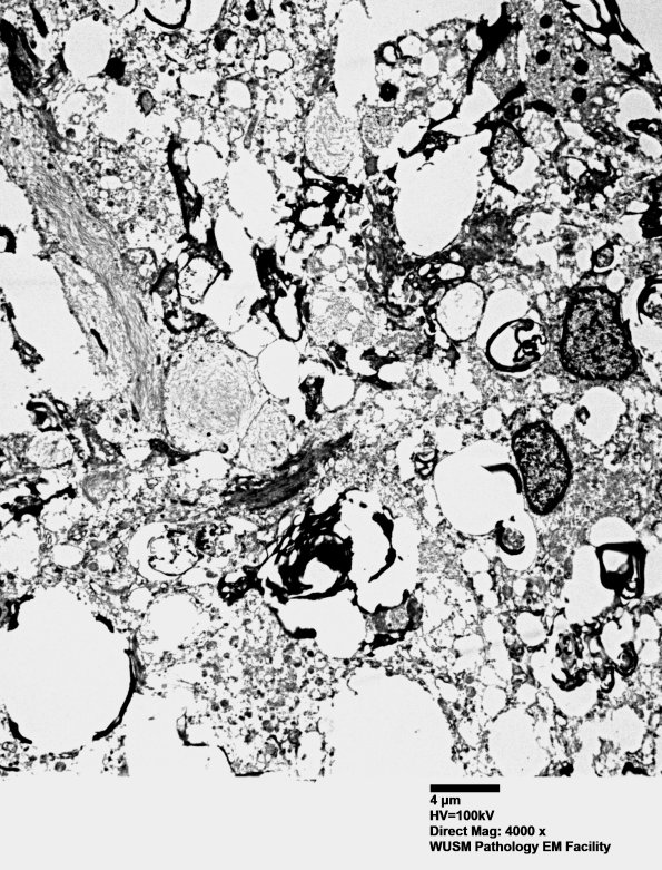 15K3 Case 15 EM 027A2 - Copy