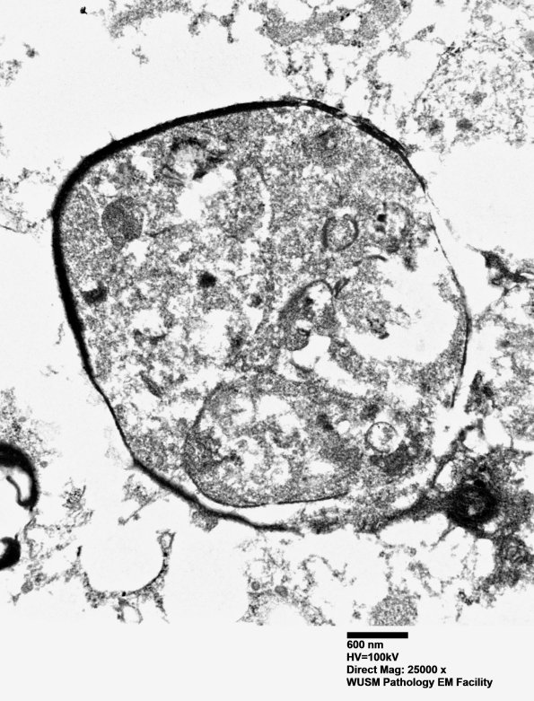 15K4 Case 15 EM 024A - Copy