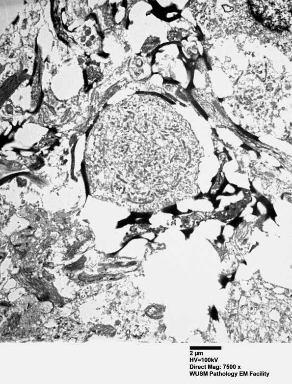 15K5 Case 15 EM 028A - Copy