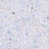 16I2 Inflammatory Demyelination (Case 16) Ki67 20X 3