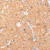 2L3 Inflammatory Demyelination (Case 2) Area C GM edge 40X NF 1