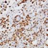 5E2 Inflammatory Demyelination (Case 5) CD68 1