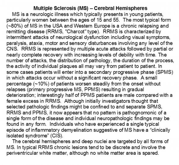 0A MS - Cerebral Hemispheres - Text A