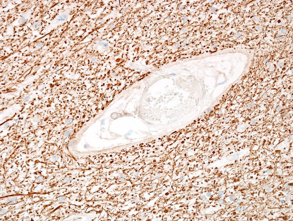 2C3 MS, inactive (Case 2) NF 40X