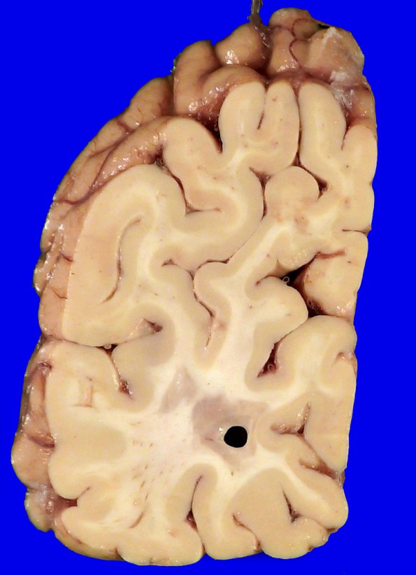 5B MS (Case 5)_5A